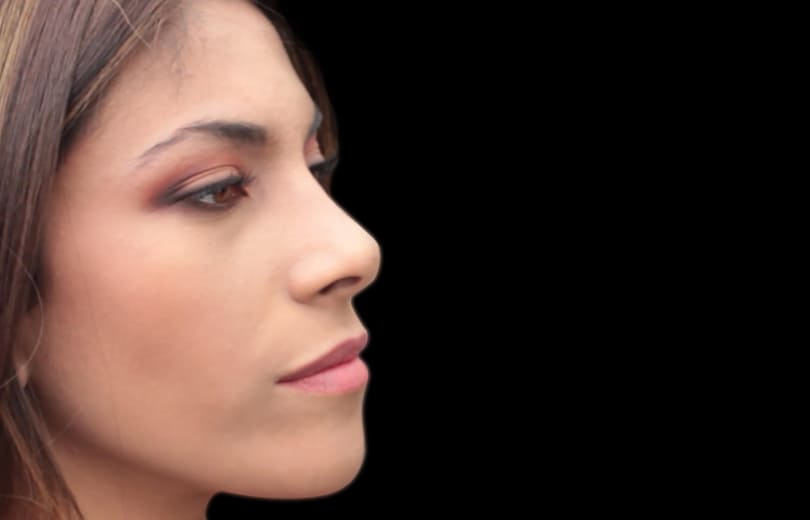 Perfiloplastia ML Mauricio Linares Garzón