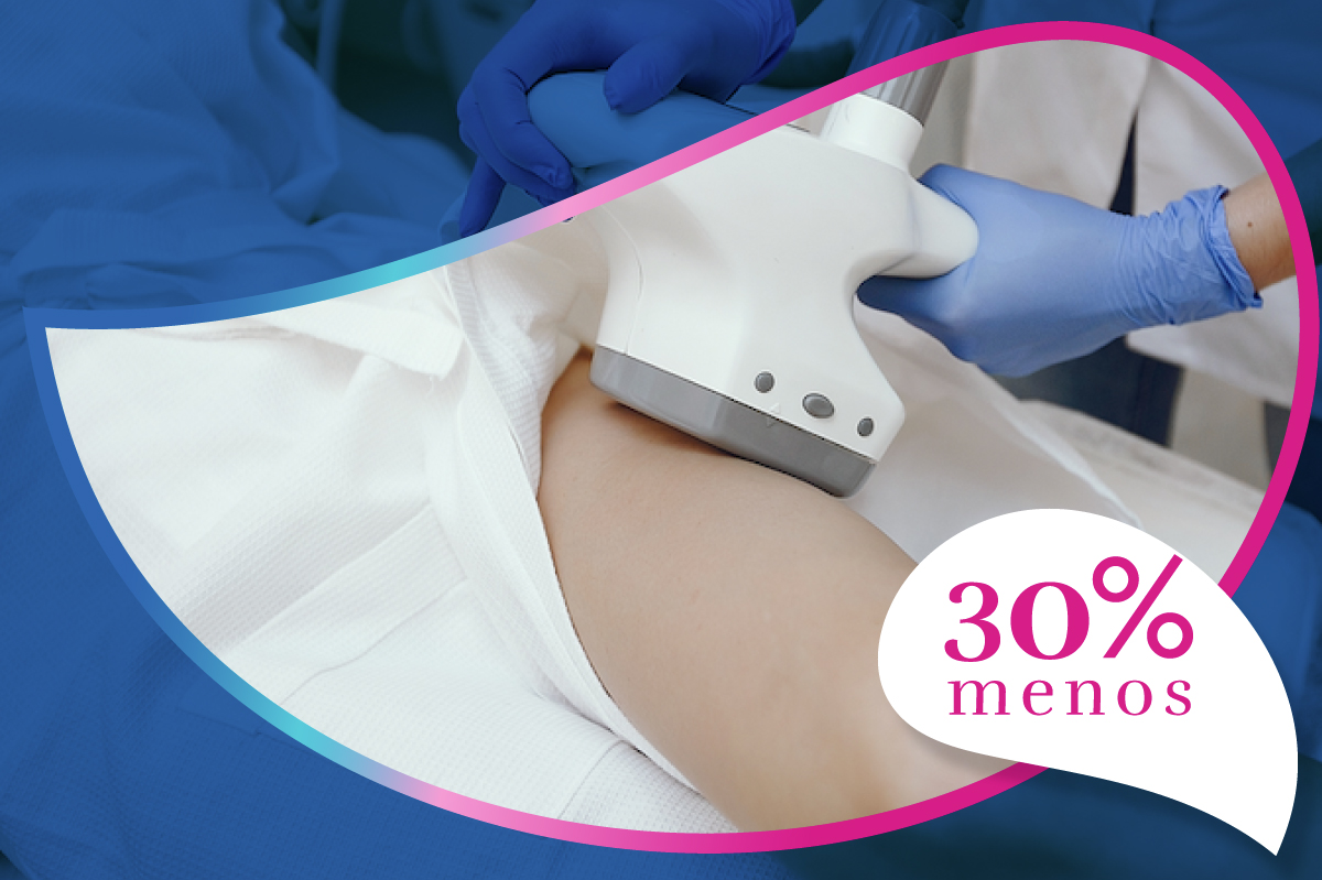 Lipolisis Laser en ML