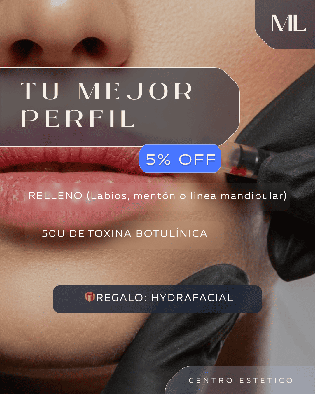 Relleno de labios